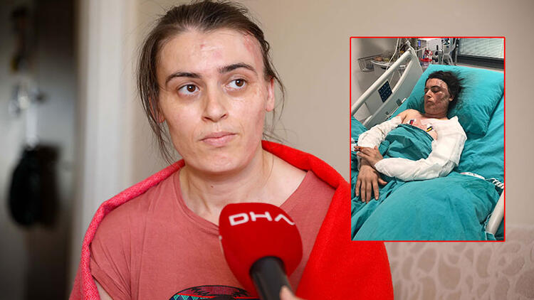 Gaziosmanpaşa'da eski elti dehşeti: 17 kez bıçaklayıp, üzerine kaynar su döktü 