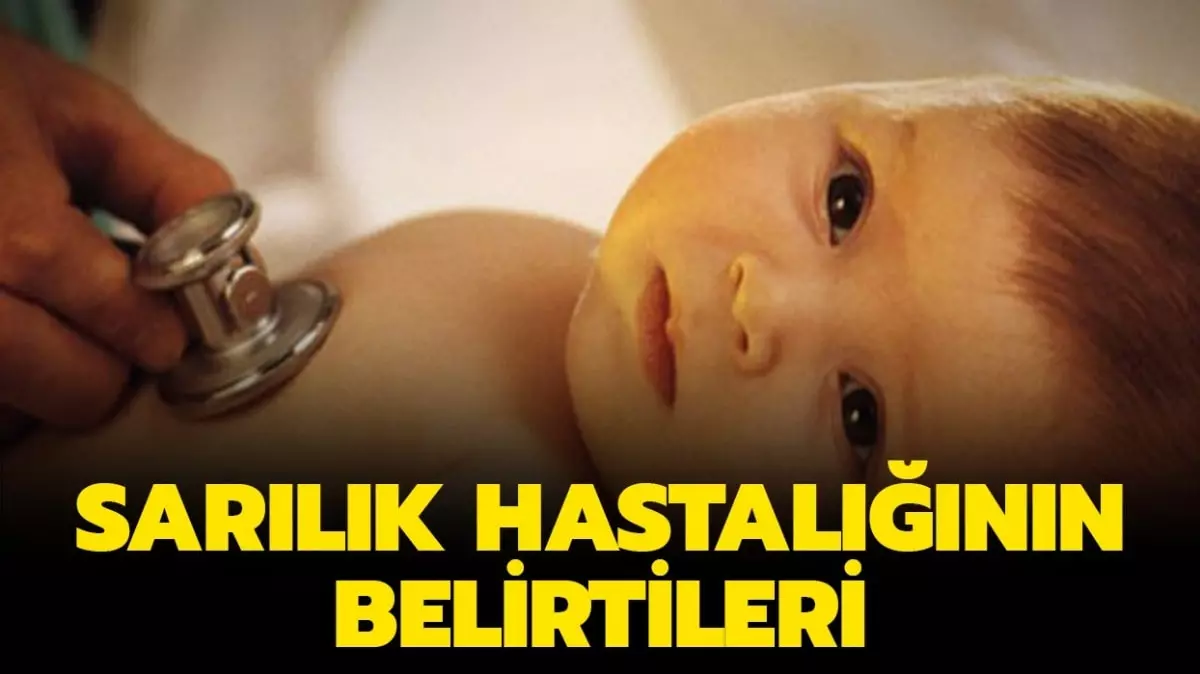 Sarılık nedir, neden olur? Sarılık hastalığı belirtileri ve tedavisi