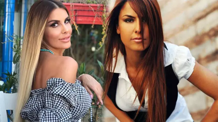Tuğçe Özbudak kimdir? Kısmi felç geçiren Tuğçe Özbudak sağlık durumu nasıl?