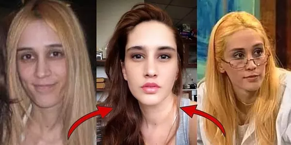 Zeynep Koçak kimdir, kaç yaşında? Zeynep Koçak son hali! Zeynep Koçak İnstagram hesabı nedir?