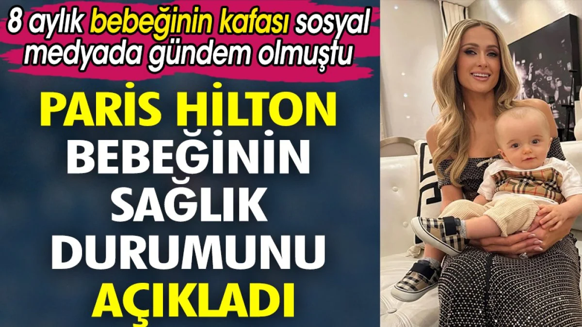Paris Hilton bebeğinin sağlık durumunu açıkladı. 8 aylık bebeğinin kafası sosyal medyada gündem olmuştu