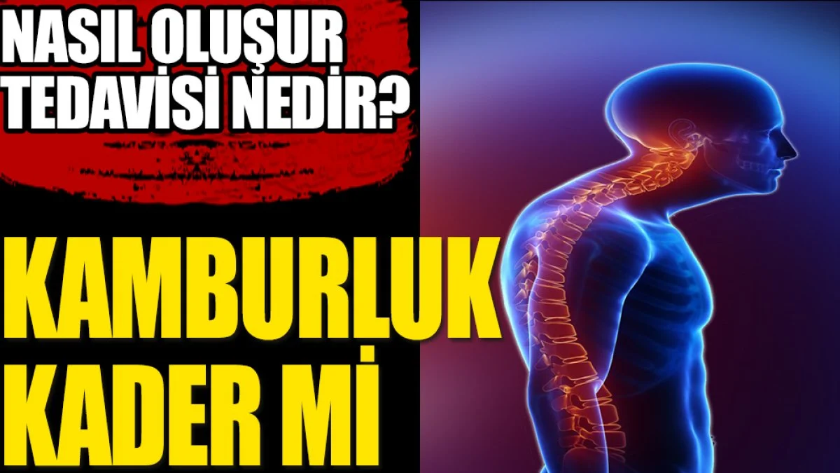 Kamburluk kader mi