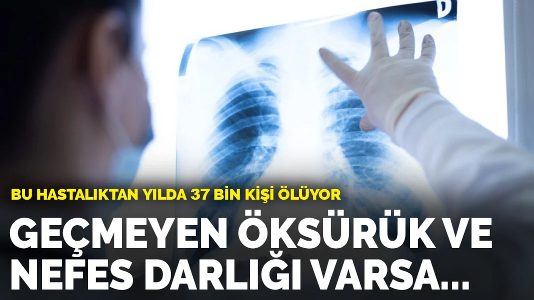 Bu hastalıktan yılda 37 bin kişi ölüyor: Geçmeyen öksürük ve nefes darlığı varsa dikkat!