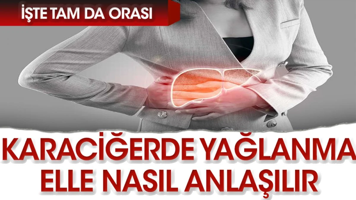 6 belirtide karaciğer yağlanması