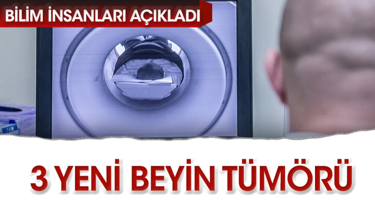 O tümörde büyük keşif