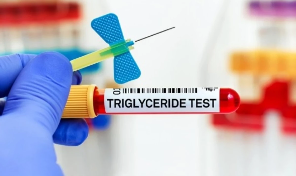 Trigliserid yüksekliği neden olur? Trigliserid belirtileri neler?