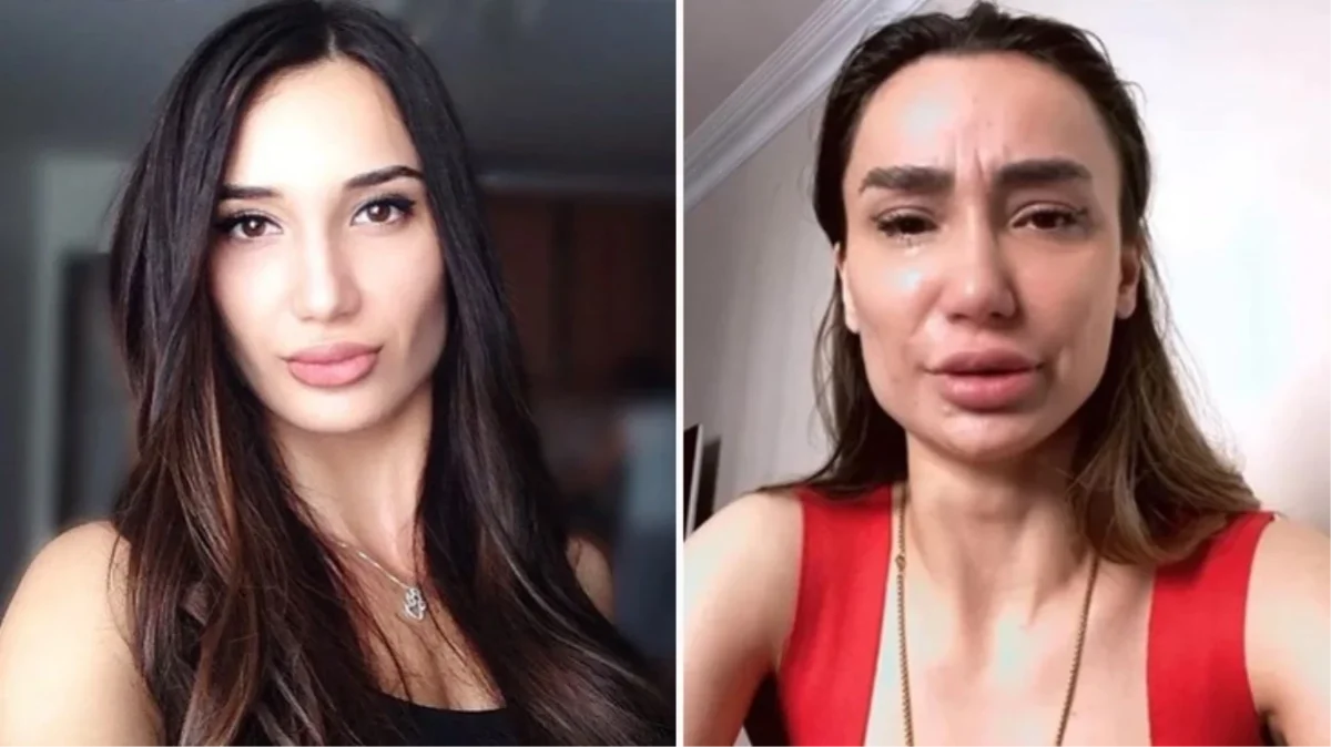 Yağmur Sarnıç neden intihar etti, ne oldu? Yağmur Sarnıç'ın sağlık durumu nasıl?