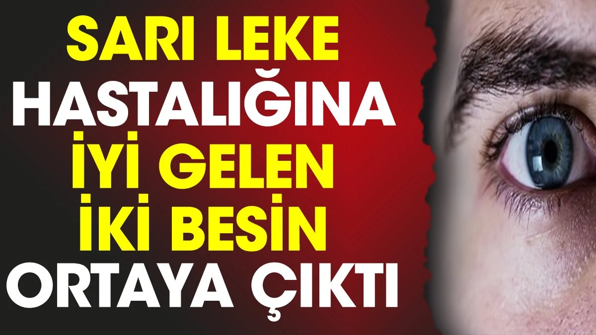 Sarı leke hastalığına iyi gelen iki besin ortaya çıktı