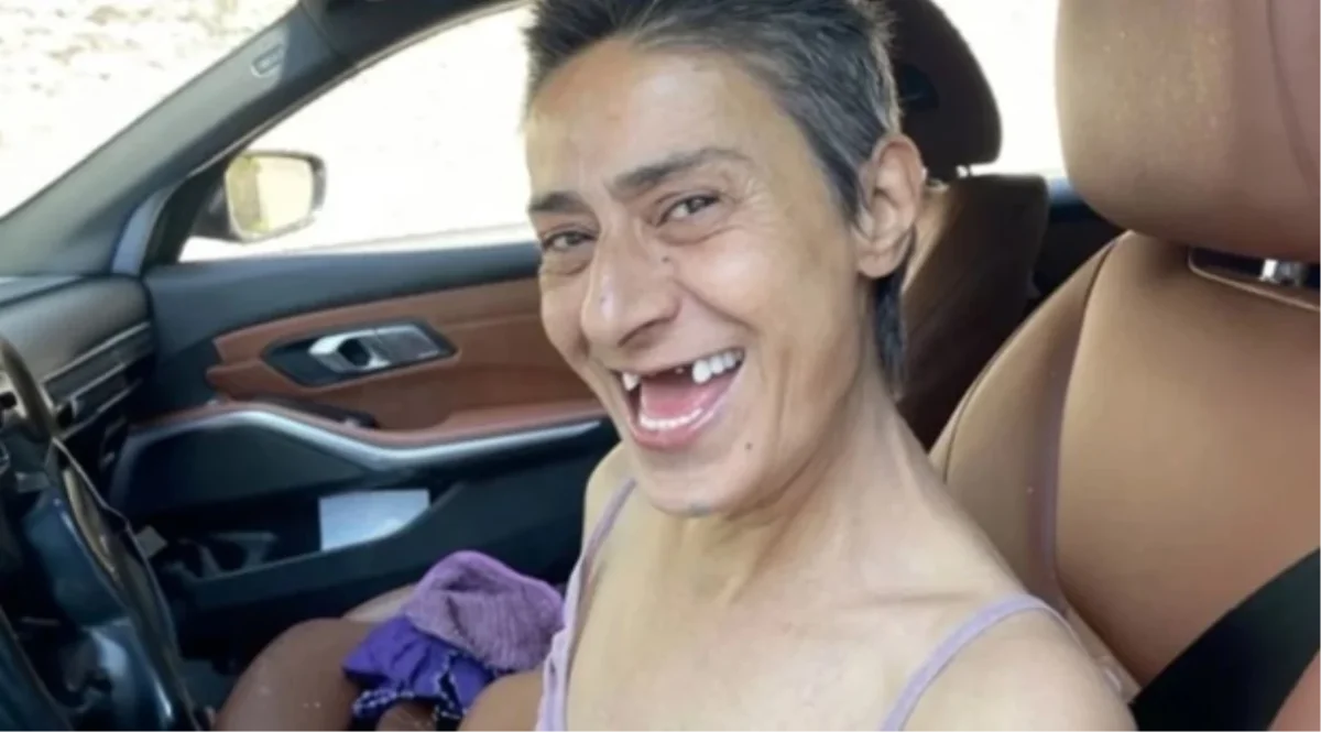 Yıldız Tilbe'nin dişleri neden yok? Yıldız Tilbe'in dişsiz pozu olay oldu!
