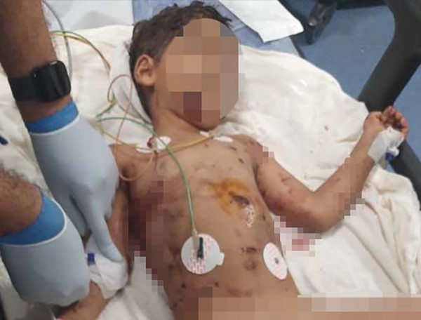 Adana'da 5 yaşındaki çocuğa ne oldu? Çocuğun sağlık durumu nasıl?