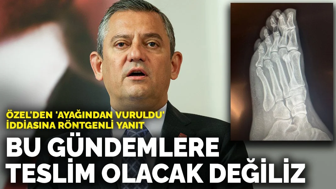 Özel'den 'ayağından vuruldu' iddiasına röntgenli yanıt: Bu gündemlere teslim olacak değiliz