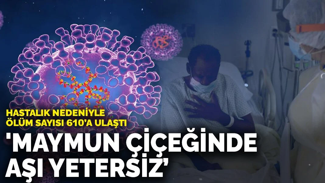 M-Çiçeği Salgınında Aşı Yetersizliği Krizi: Ölü Sayısı 610’a Ulaştı