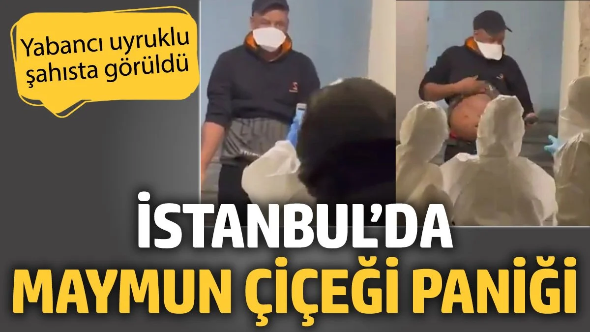 İstanbul Beyoğlu'nda Maymun Çiçeği Paniği: Yabancı Uyruklu Kişi Karantinaya Alındı