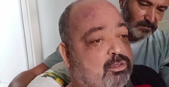 Siroz hastası vatandaş: 