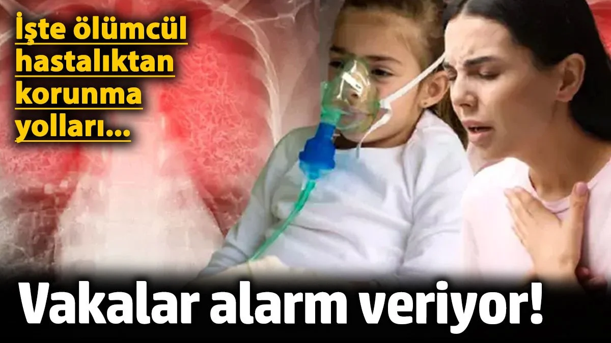 Zattürre vakaları alarm veriyor! Uzmanlar ölümcül hastalıktan korunma yollarını anlattı