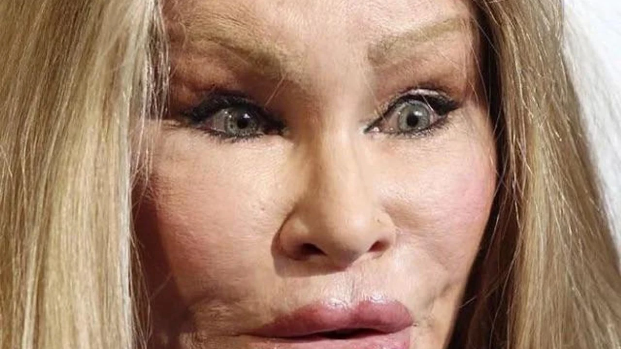Kedi Kadın Jocelyn Wildenstein Hayatını Kaybetti: Estetik Tutkusu ve Fırtınalı Yaşamı