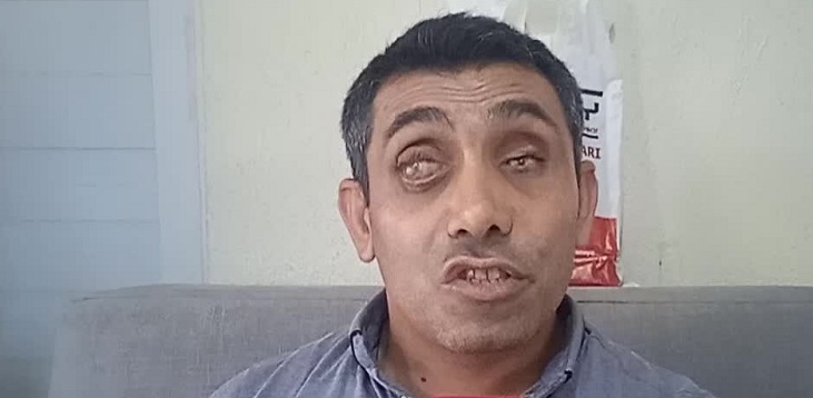 Osmaniye’de görme engelli öğretmen, dolmuşta sözlü tacize uğradığını iddia etti
